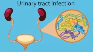 Urinary Tract Infection or Fever