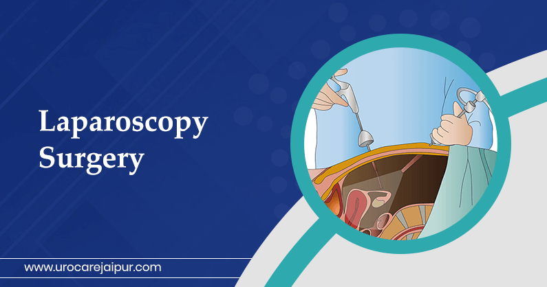 laparoscopy-surgery-in-jaipur